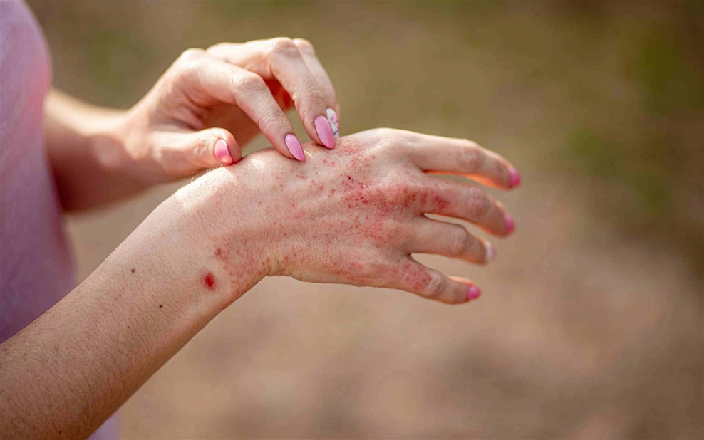 Paracetamol Powder CAS 103-90-2 | Shaanxi BLOOM Tech Co., Ltd Paracetamol Powder CAS 103-90-2 | Shaanxi BLOOM Tech Co., Ltd